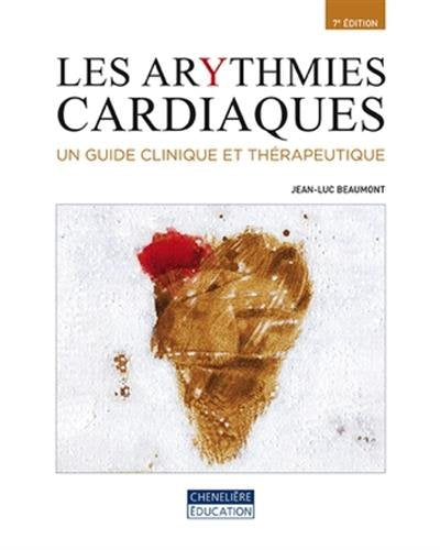 Les Arythmies Cardiaques