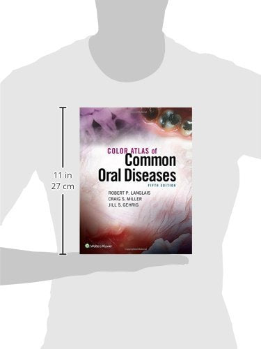 Color Atlas Of Common Oral Diseases