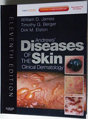 Andrews' Diseases Of The Skin Clinical Dermatology   Expert Consult   Online And Print