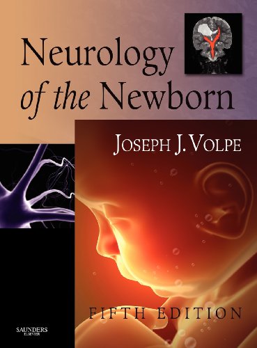 Neurology Of The Newborn