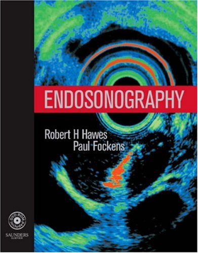 Endosonography