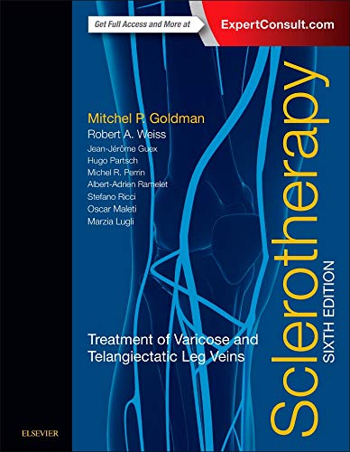 Sclerotherapy Treatment Of Varicose And Telangiectatic Leg Veins