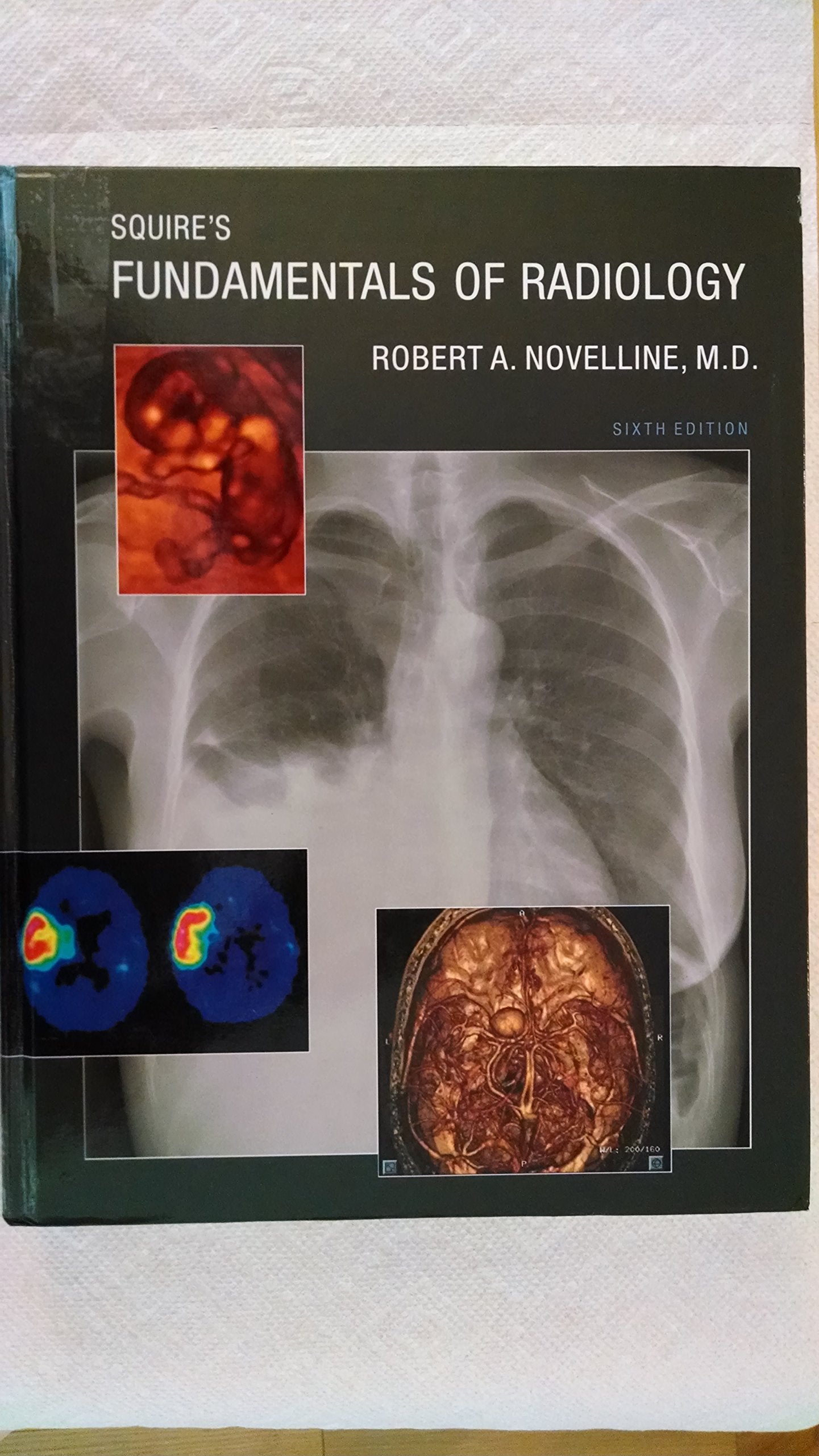 Squire’s Fundamentals Of Radiology Sixth Edition