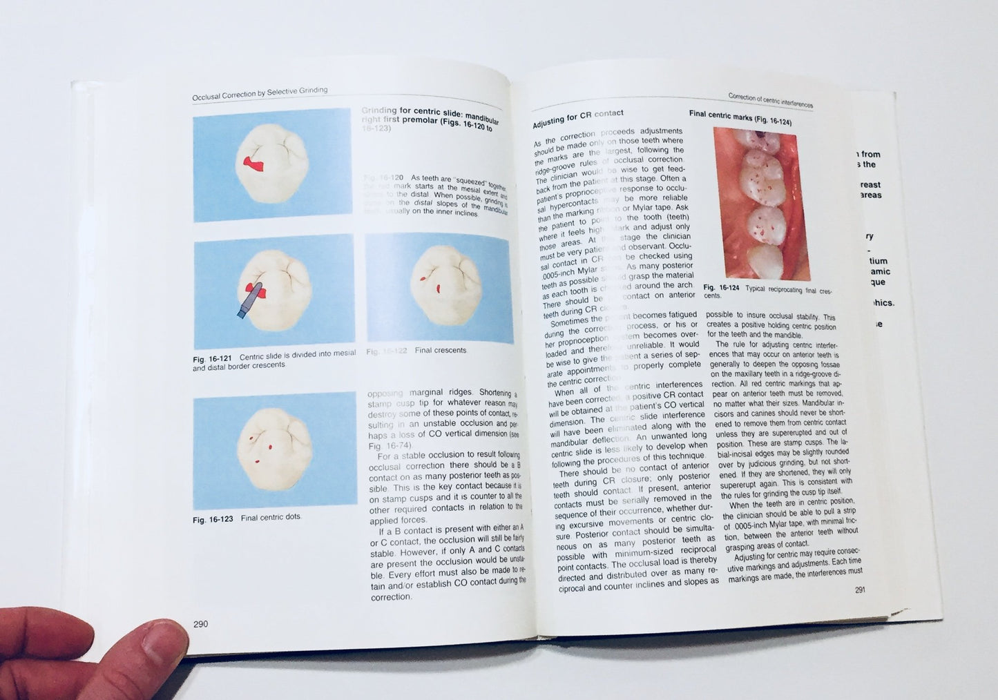 Occlusal Correction Principles And Practice