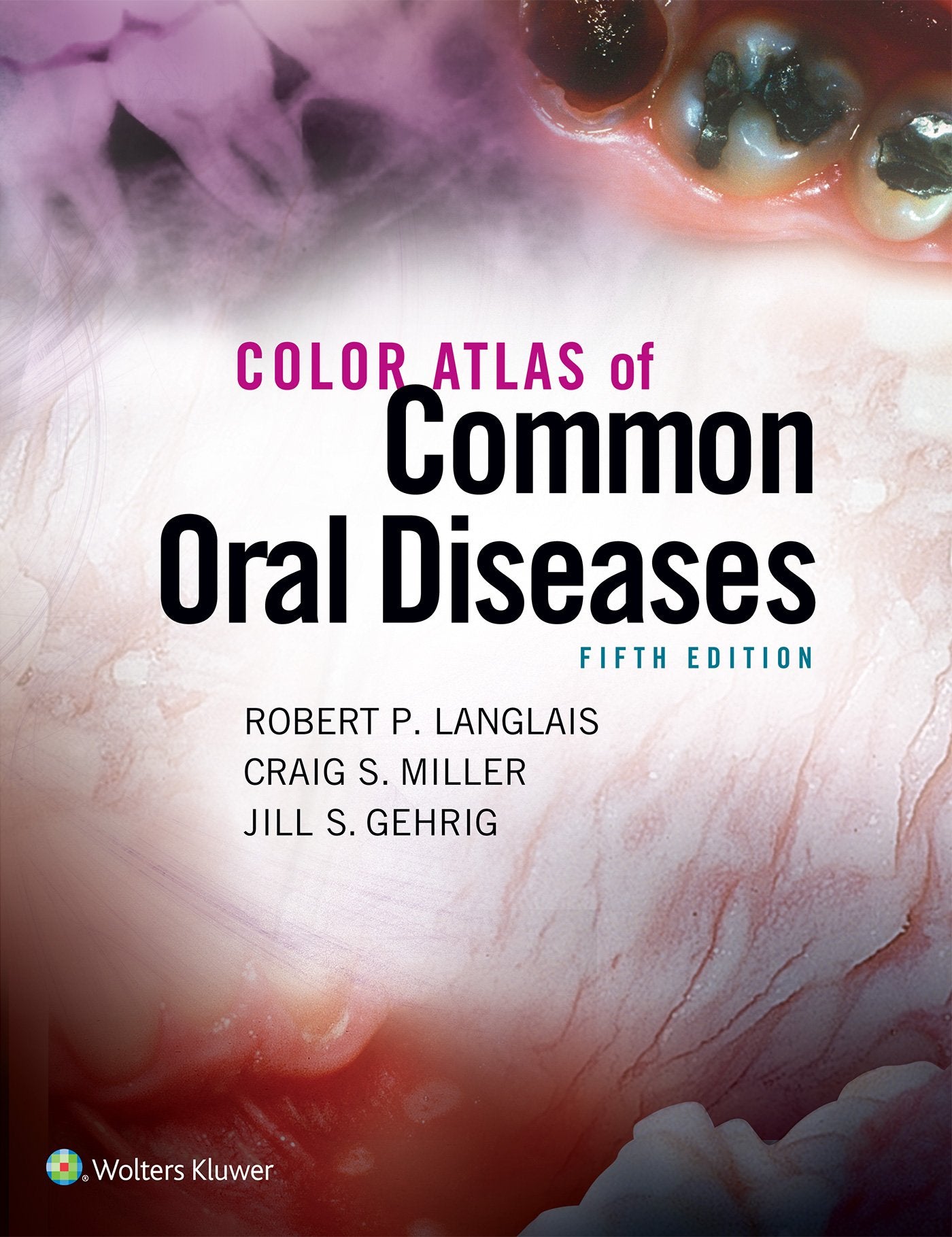 Color Atlas Of Common Oral Diseases