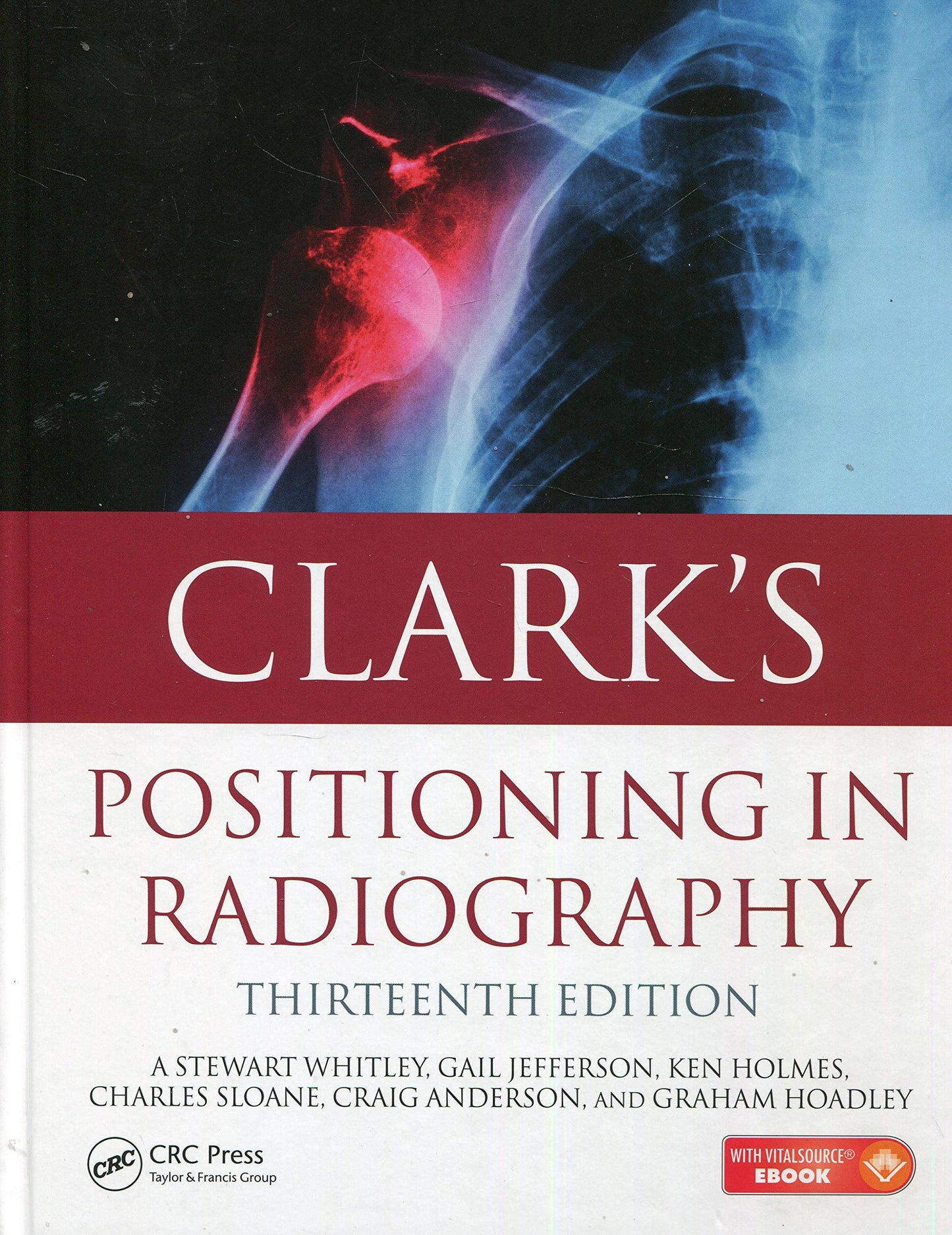 Clark's Positioning In Radiography