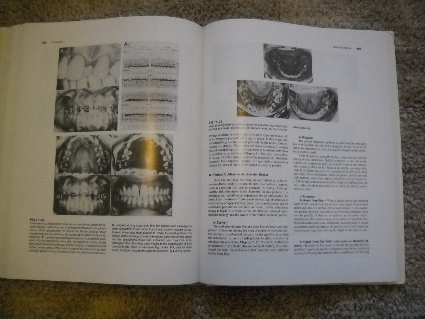 Handbook Of Orthodontics