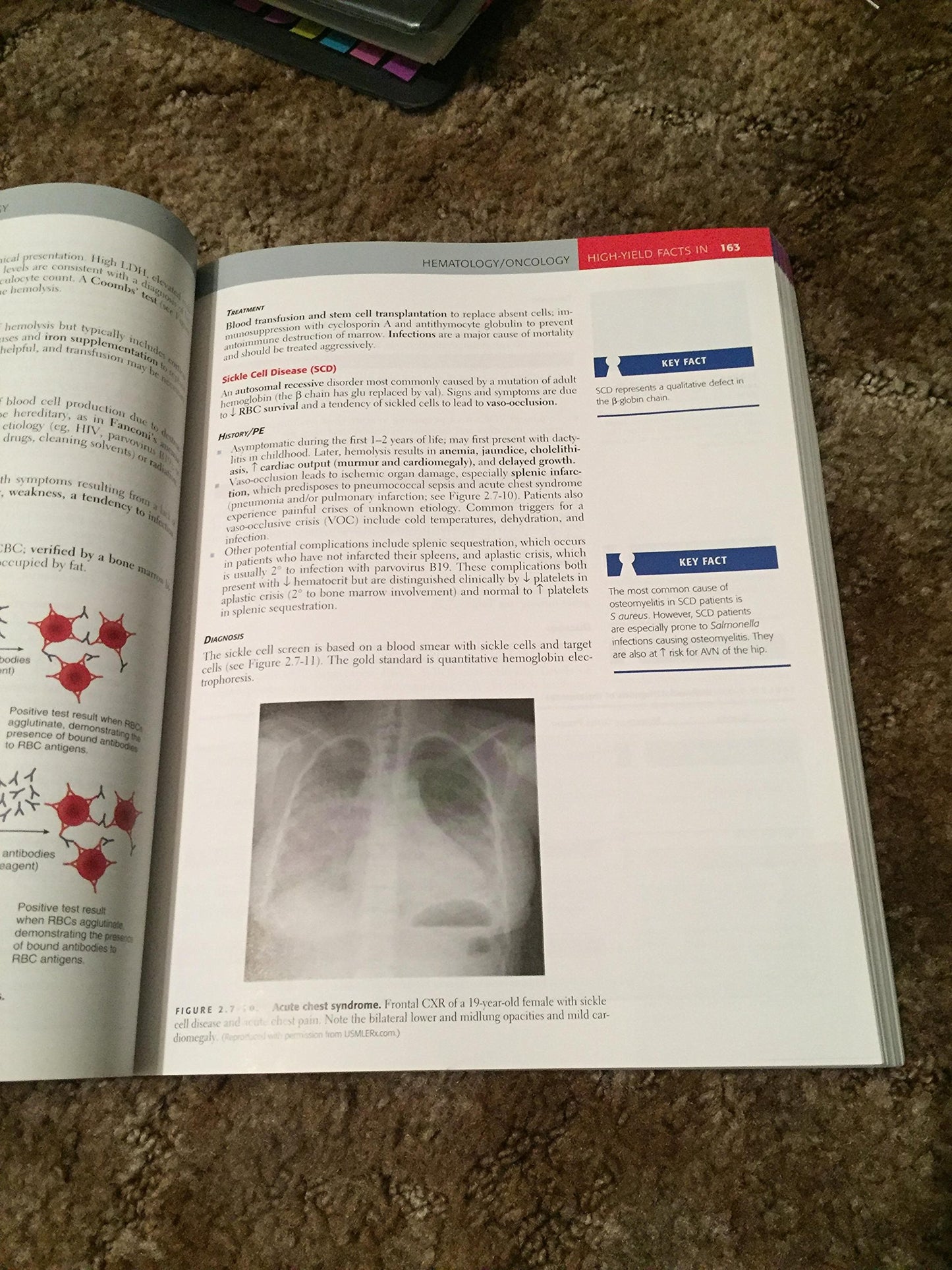 First Aid For The Usmle Step