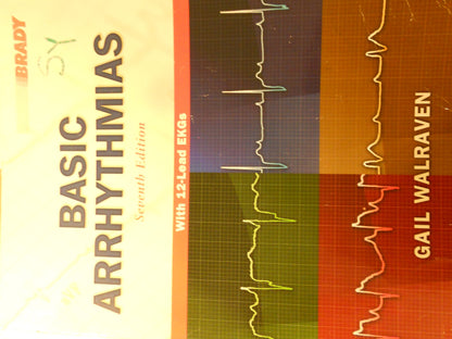 Basic Arrhythmias